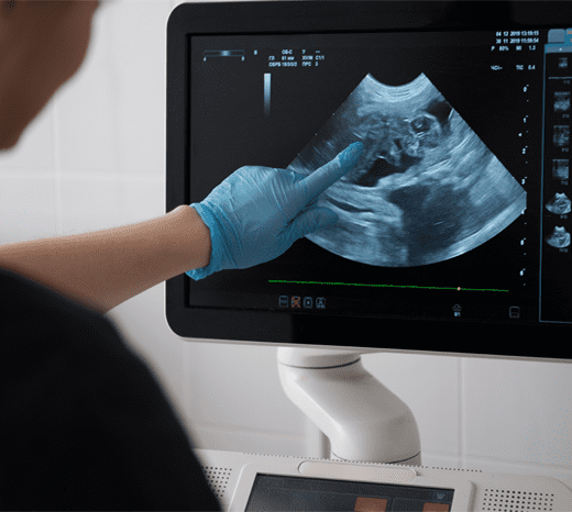 X Ray and Ultrasound